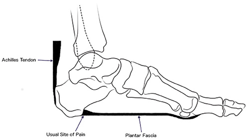 The plantar fascia